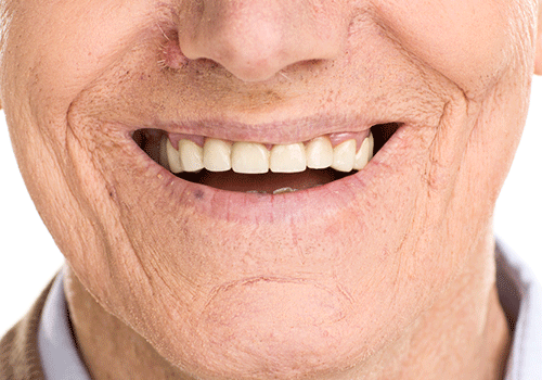 smiling elderly man with natural looking dental implants